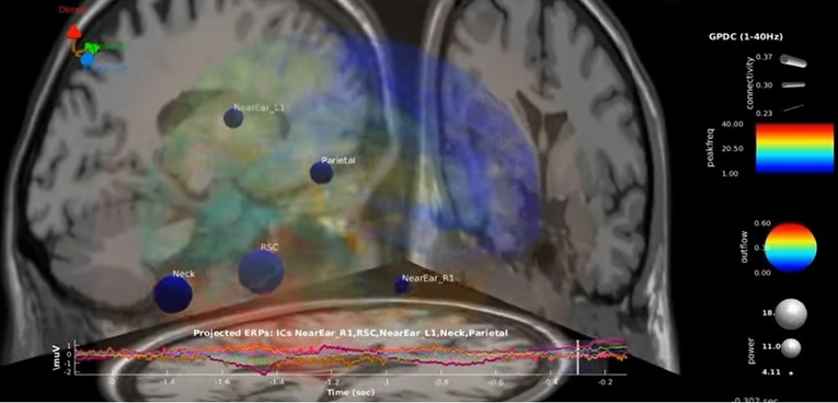 Sztuczna inteligencja czyta myśli i zamienia je na mowę