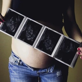 Felek mógł żyć. Prokuratura bada śmierć dziecka zabitego w 37. tygodniu ciąży