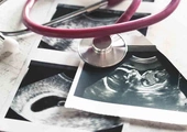 Anglia i Walia: Prawie co trzecia ciąża kończy się aborcją