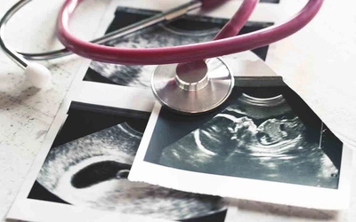 USA: od 1991 r. zamknięto 70 proc. klinik aborcyjnych