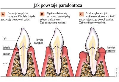 Trzymaj się, zębie!