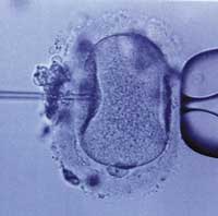 Czego nie widać in vitro?